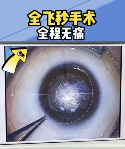 西安飞秒激光手术哪家医院好？2026权威测评+个性化选择指南