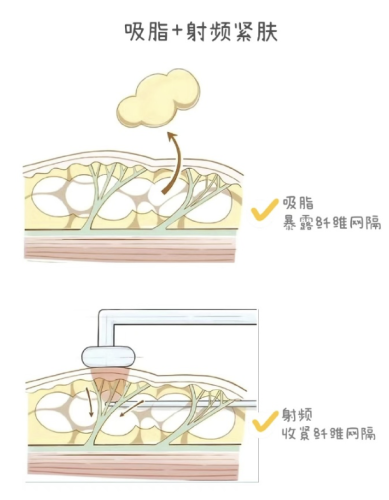 截屏2026-01-09 15.07.42.png
