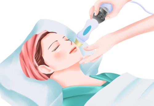 下颌缘黄金微雕什么时候才有效果？肿胀期、代谢期、定型期效果出现时间全说明