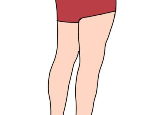 大腿抽脂有什么风险和后遗症？先扒清楚这些风险后遗症，别盲目跟风