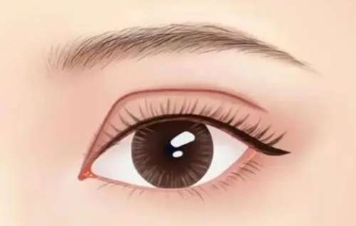 双眼皮 双眼皮