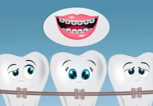 牙齿矫正