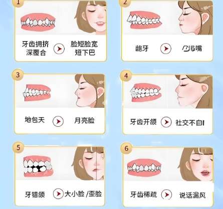 牙齿矫正 牙齿矫正