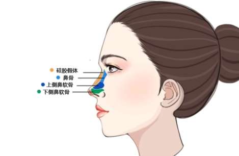 钱玉鑫鼻子案例图曝光|钱医生做的自然吗？如何避免“网红风”
