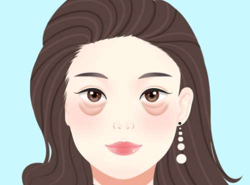 眼袋 眼袋