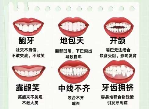 牙齿矫正 牙齿矫正