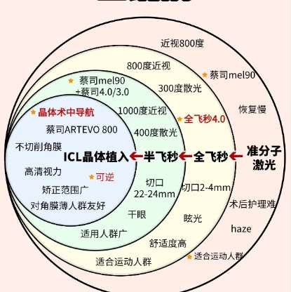 近视眼矫正 近视眼矫正