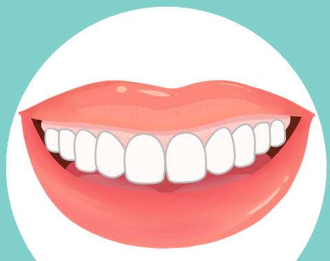 牙贴面动漫图.jpg 牙贴面动漫图.jpg