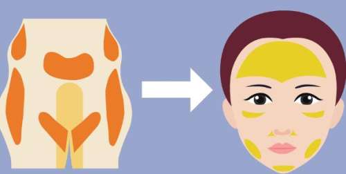 面部填充 面部填充