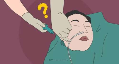 面部填充 面部填充