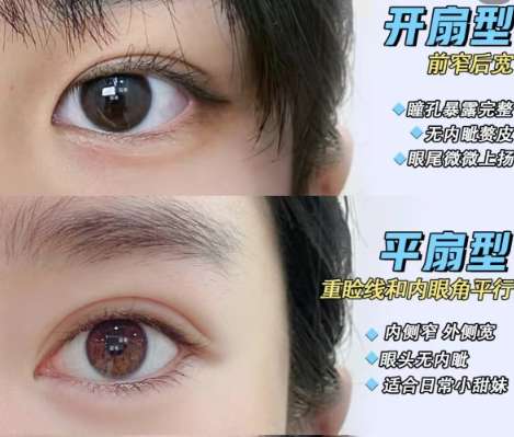 双眼皮 双眼皮
