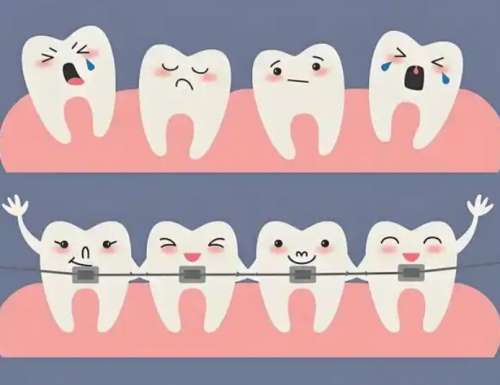 牙齿矫正 牙齿矫正