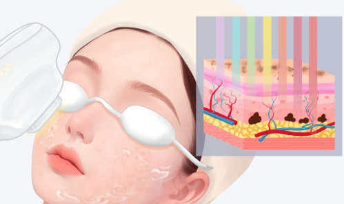 成都黄金微针哪家医院好？口碑不错的医院+大致价格范围参考