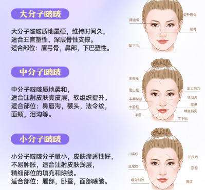 注射美容 注射美容