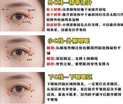 注射美容 注射美容