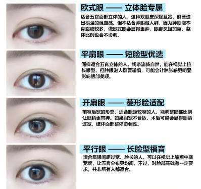 双眼皮 双眼皮