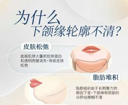 下颌缘提升 下颌缘提升