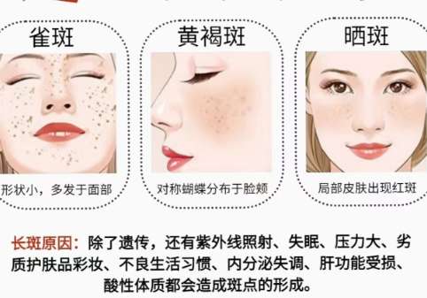 祛斑