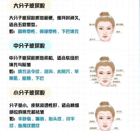 注射美容 注射美容