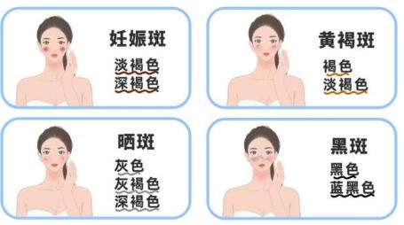 祛斑 祛斑