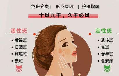 祛斑 祛斑