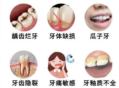 牙齿修复 牙齿修复