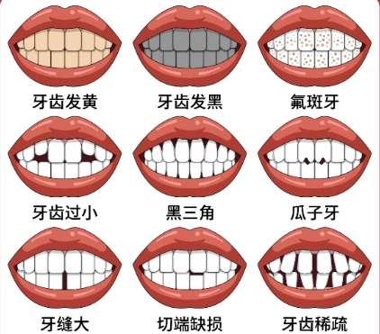 牙齿修复 牙齿修复