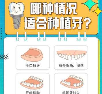 牙齿种植dm