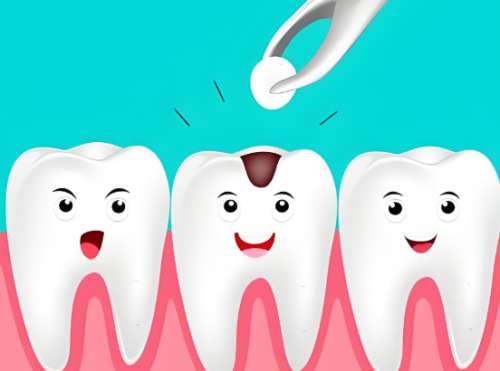 北医三院牙齿种植多少钱？普通人能看懂的费用全拆解