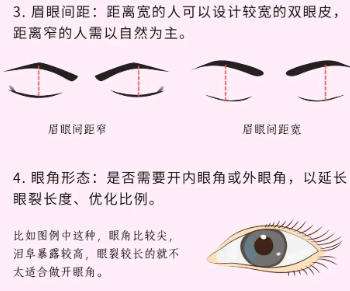 双眼皮 双眼皮